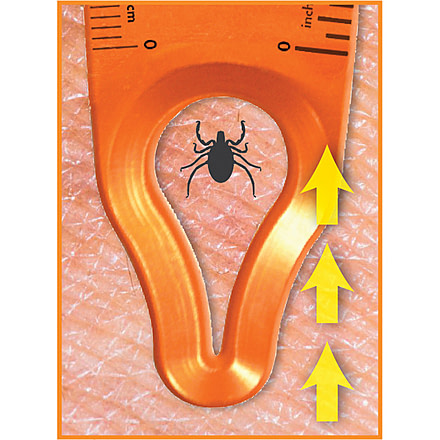 Ultimate Survival Tick Wrangler 20-BUG00004-08