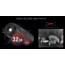 ATN BlazeSeeker 210 Gen 6 Thermal Monocular