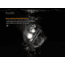 Fenix Lighting HM65R Lithium Ion 1400 Lumens Cree XM-L2 U2 , XP-G2 R5 LED Headlamp, Black, HM65RL2BK