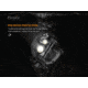 Fenix Lighting HM65R Lithium Ion 1400 Lumens Cree XM-L2 U2 , XP-G2 R5 LED Headlamp, Black, HM65RL2BK